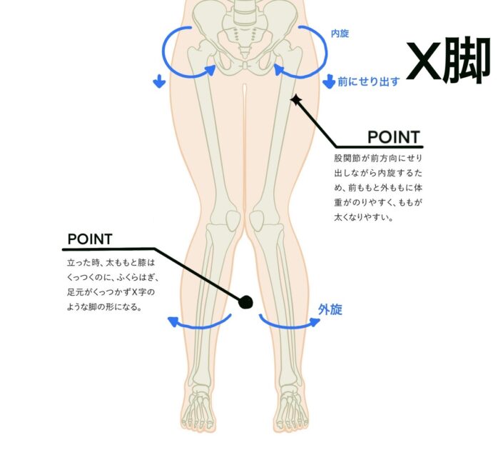 O脚・X脚 | WELLNESS JAPAN body management