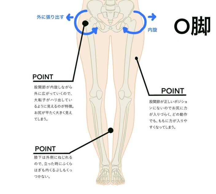 O脚・X脚 | WELLNESS JAPAN body management